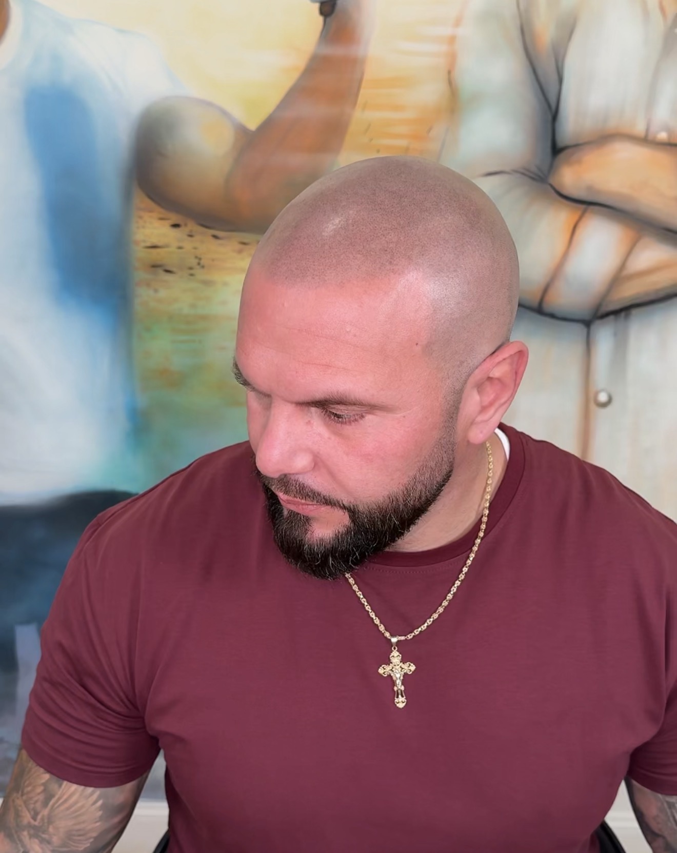 Before using Folicule Anti-Shine — shiny scalp